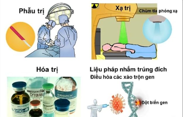 Các phương pháp điều trị ung thư phổi hiệu quả